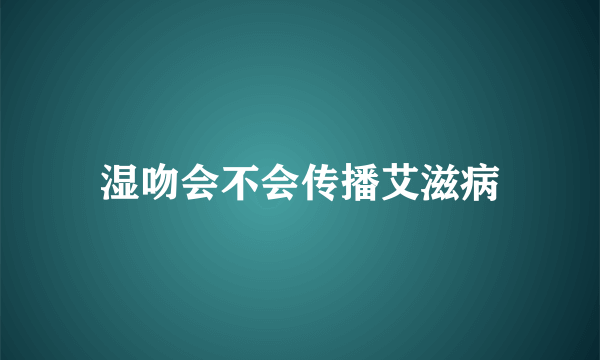 湿吻会不会传播艾滋病